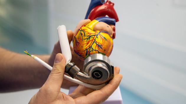 Стаття В Александровской больнице Киева впервые провели операцию по имплантации механического сердца Ранкове місто. Крим