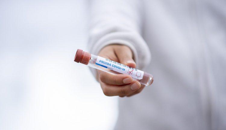 Стаття Проверка на коронавирус: кому полагается бесплатное тестирование? Ранкове місто. Крим